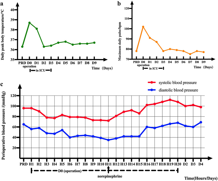 Patient vital signs chart example